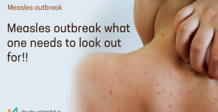 measles-outbreak