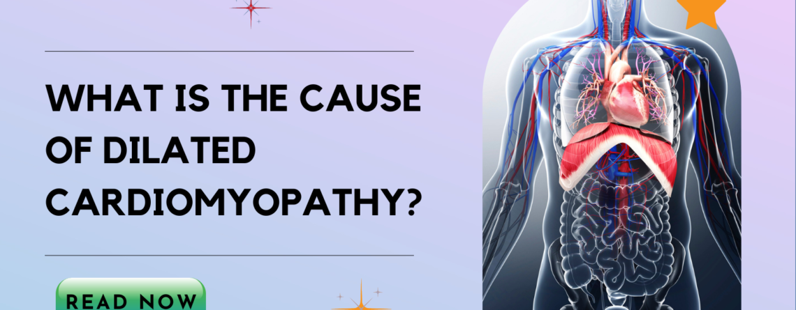 Cardiomyopathy