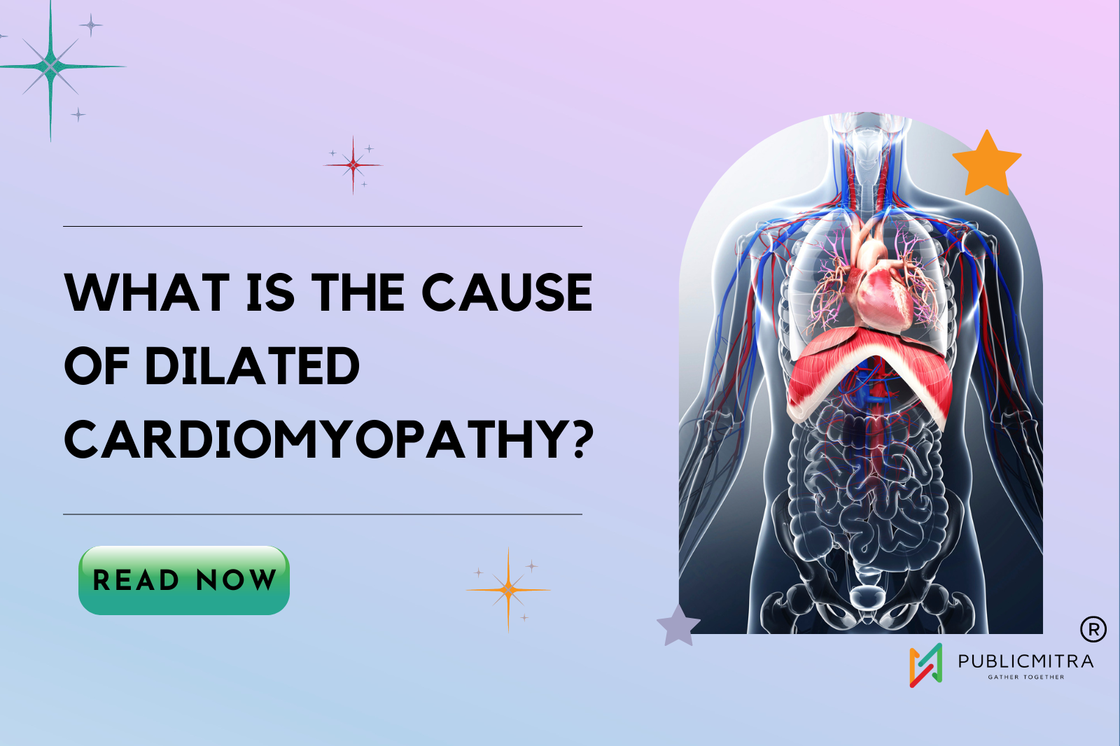 Dilated Cardiomyopathy Cause