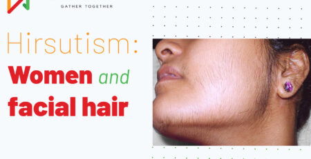 hirsutism-causes